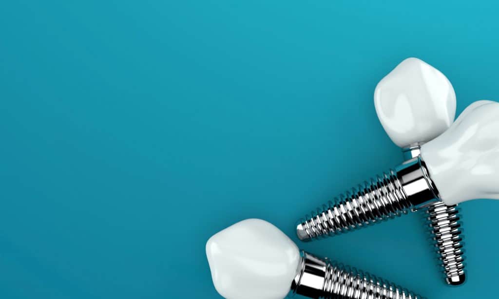 understanding dental implants